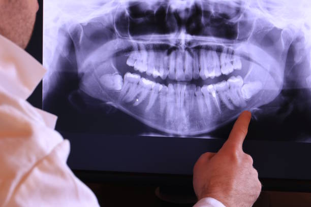 Best Orthodontic Emergency Dentist in Escatawpa, MS